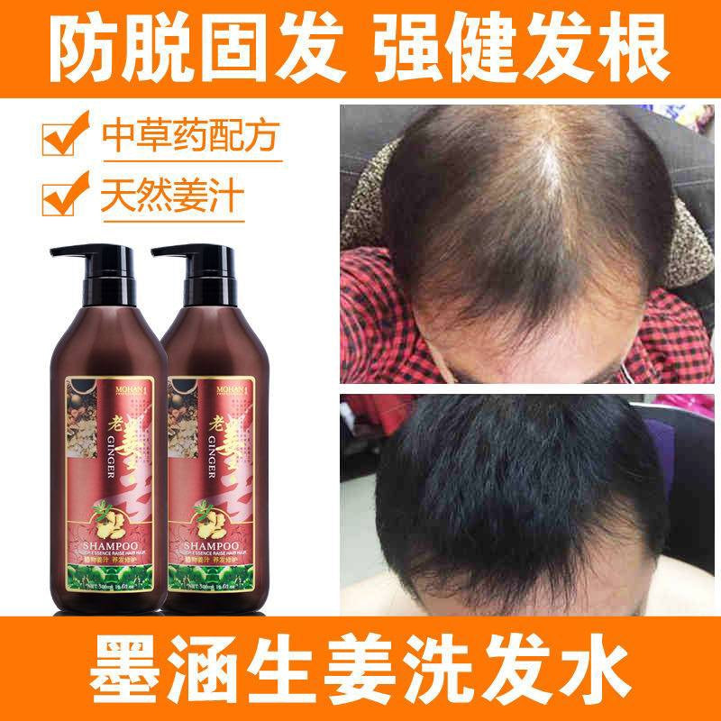 Mohan Old Ginger King Pure Ginger Extract Shampoo 500ml
