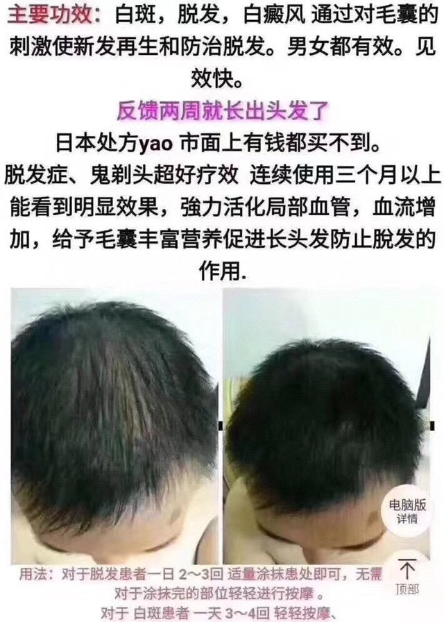日本长生堂生发剂