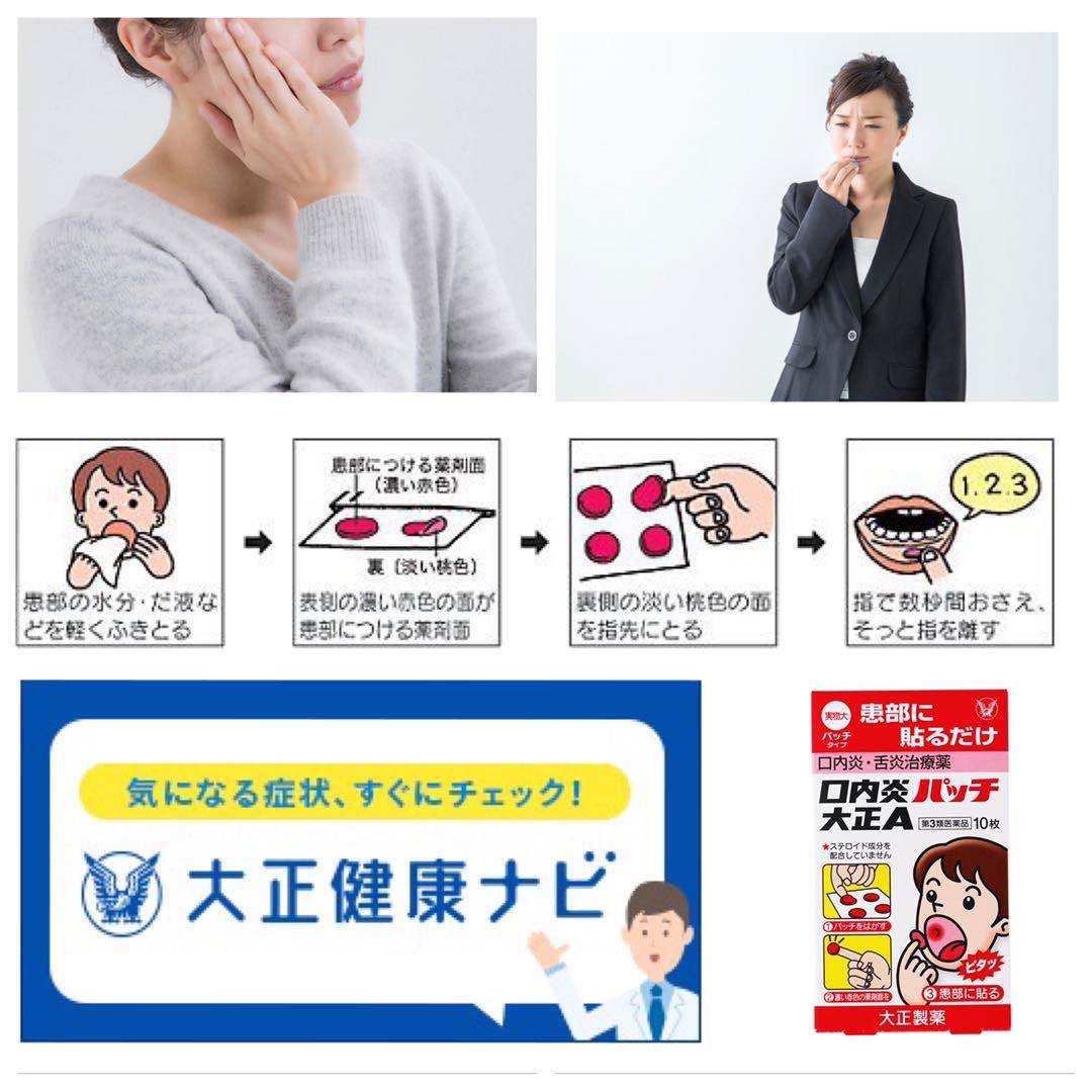 Taisho Mouth Ulcer Patches 10 patches/box