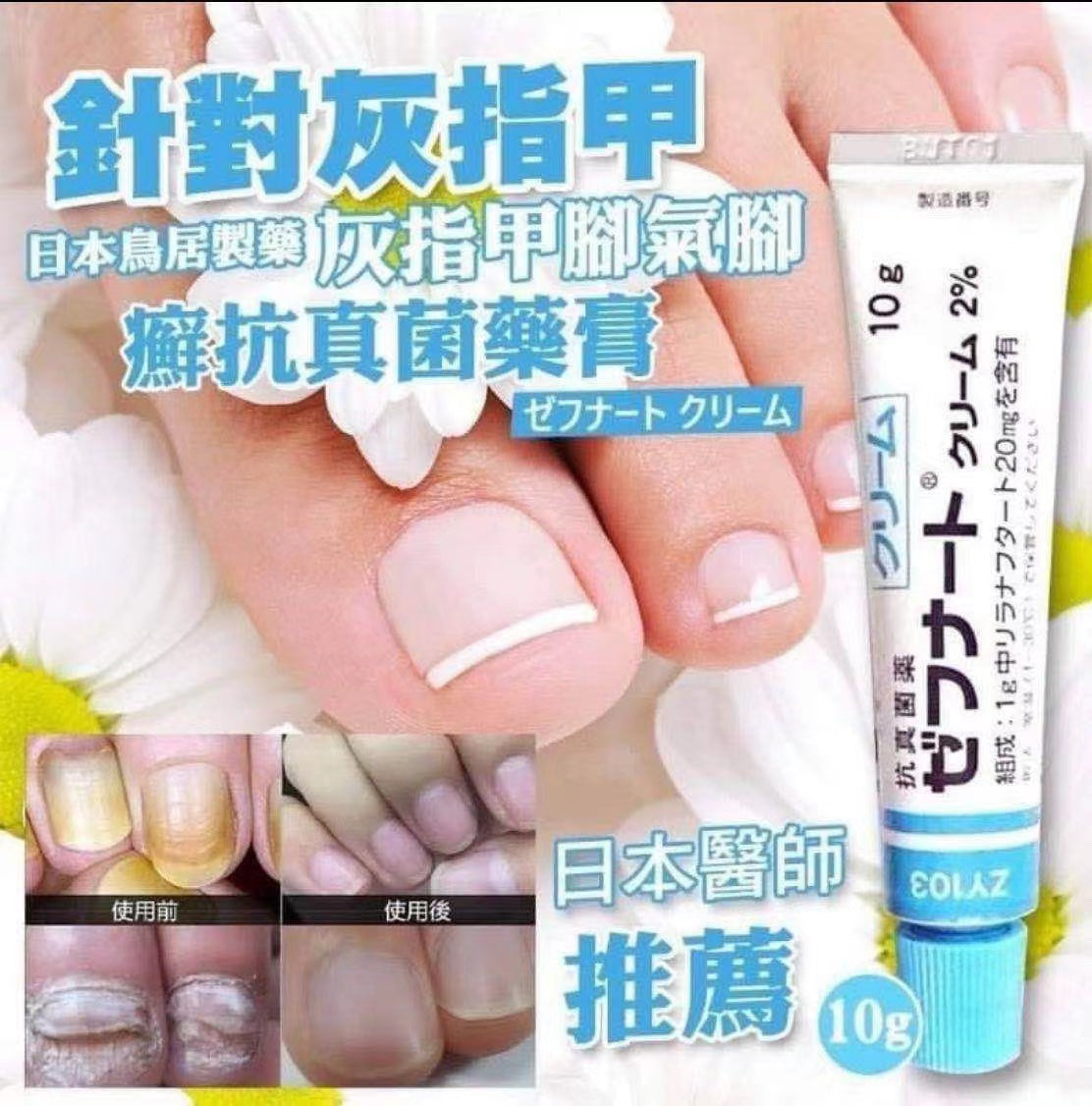 日本神奇脚气膏 10g