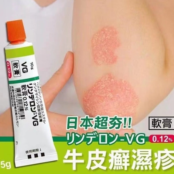 日本VG荨麻湿疹膏
